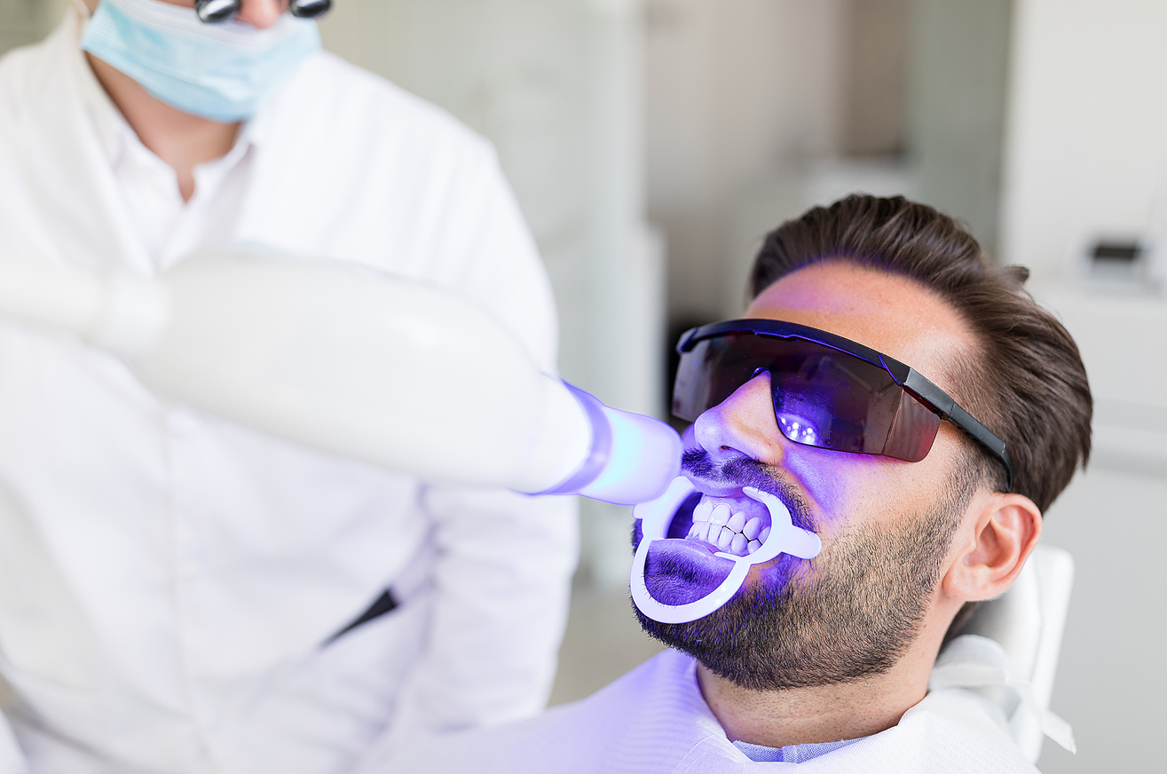 Teeth whitening